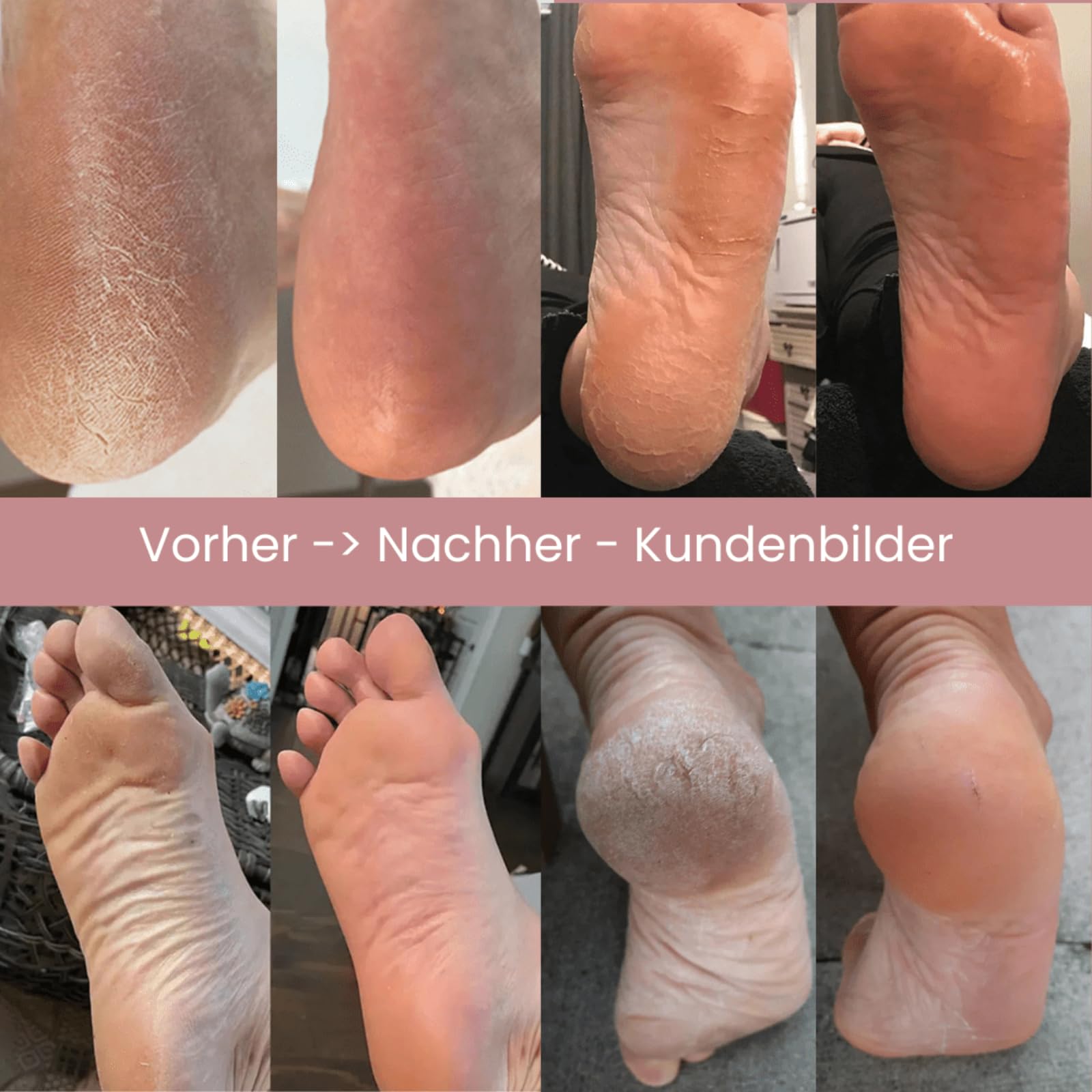 Dermaglide Hornhaut Entferner 2.0,Elektrischer Hornhautentferner,Geschwindigkeit einstellbar mit 60+10 austauschbaren Schleifscheiben,Nagelschleifer & Fußpflegeset für zu Hause