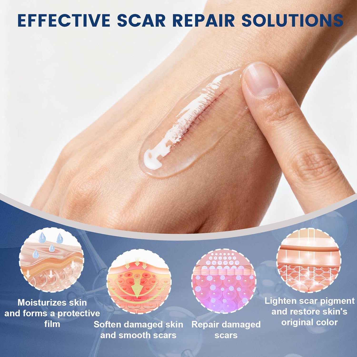 100% Silicone Scar Gel Scar Cream, Advanced Silicone Gel for Removal of Surgical, Burns, Acne Scar, Old and Recent Scars and Stretch Marks, 1.7 oz/50ml - Image 5