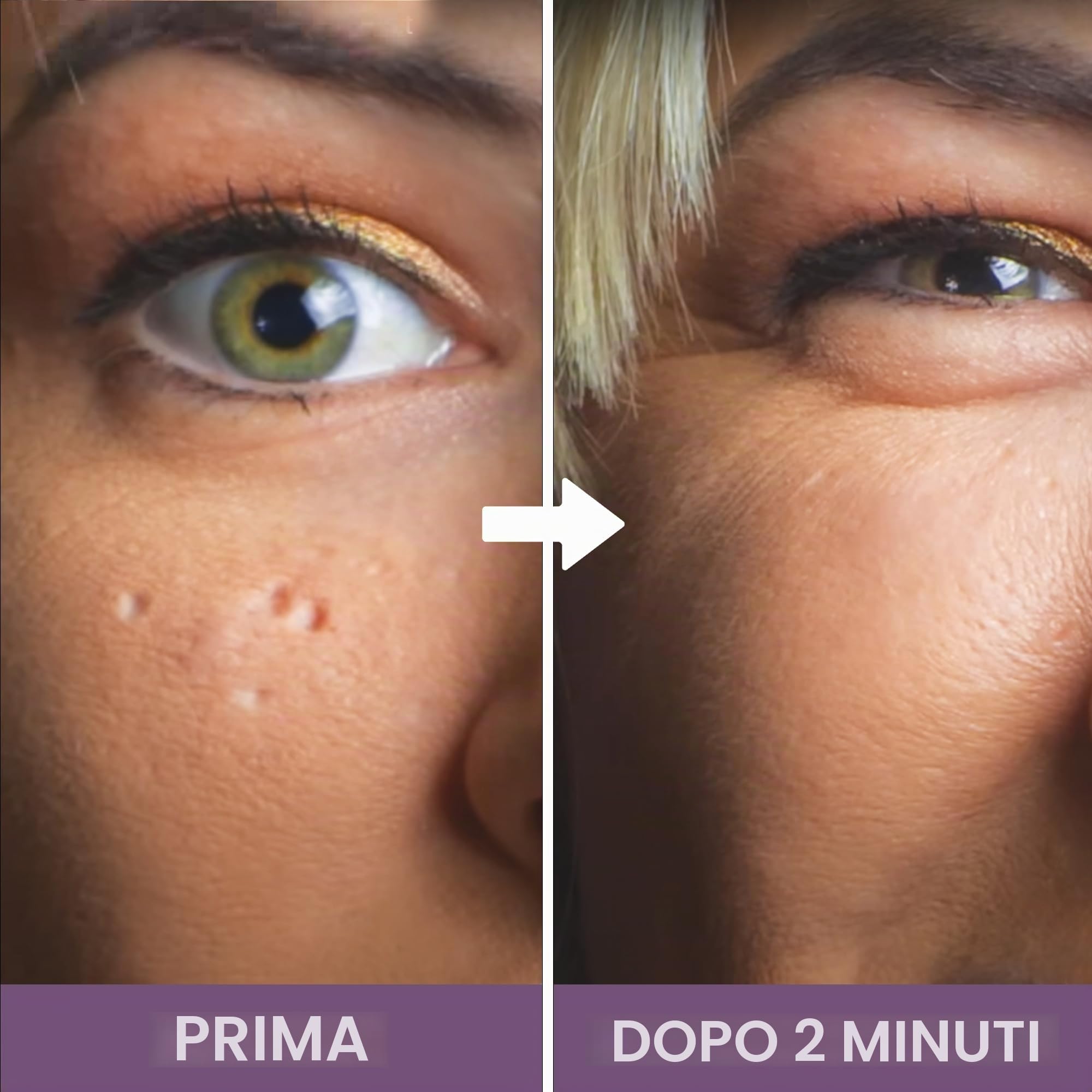 Dermaflage Cover Up – il correttore per cicatrici e linee d’espressione usato dai professionisti di Hollywood