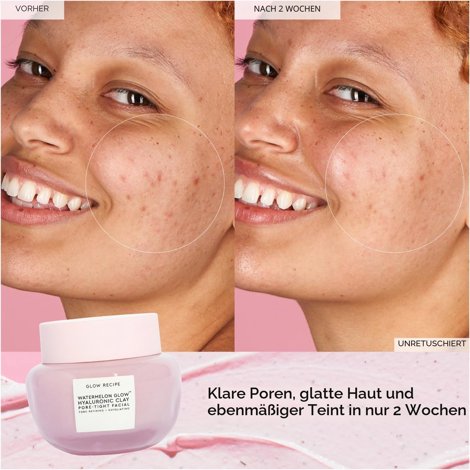 Glow Recipe Watermelon Glow Hyaluron Tonerde porenenges Gesicht – Sanfte Peeling-Tonmaske mit Hyaluronsäure – hilft, das Aussehen von Poren zu minimieren, gleichmäßiger Tonton + Hydrate (60 ml)