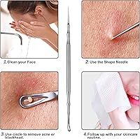 Vista 4 de Pointed Blackhead Removal, 2-in-1 Acne Extractor Tool - Stainless Steel Whitehead Remover for Face/Nose
