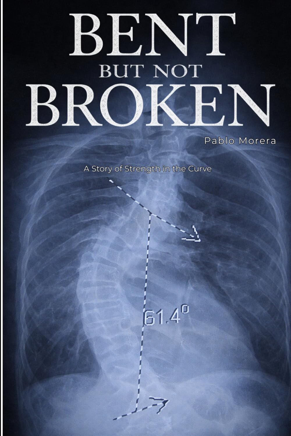 Bent but Not Broken: A Story of Strength in the Curve