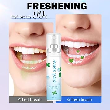 2Pcs Pro-Biotic Dry Mouth Spray & Breath Freshener Spray, Mint Flavor 20ML, Long-Lasting Moisturizing Oral Care for Bad Breath, Freshens Mouth & Fights Unpleasant Odor