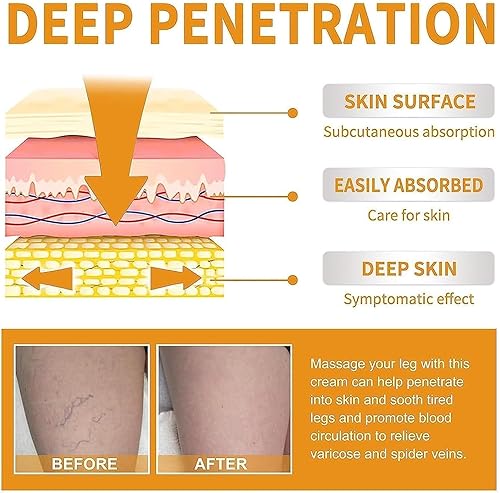Miniatura 7 de Crema milagrosa para venas varicosas, rejuvenece y mejora la circulación sanguínea para todo tipo de piel, crema de vitamina K, tratamiento de venas