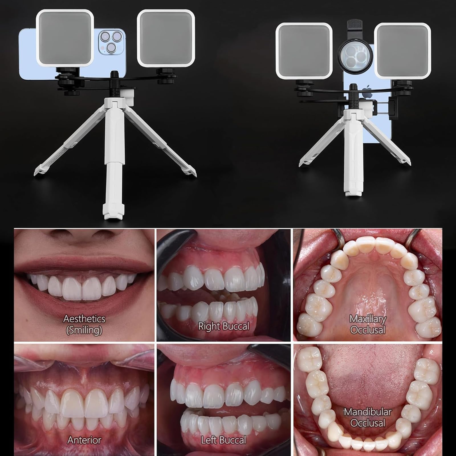 NGARY Lampe De Remplissage Dentaire pour La Photographie, Éclairage Photo Et Vidéo Dentaire 5600 K avec Filtre CPL 52 Mm, Luminosité Réglable Et Éclairement Maximal : 1370 Lux/0,3 M, pour Smartphones