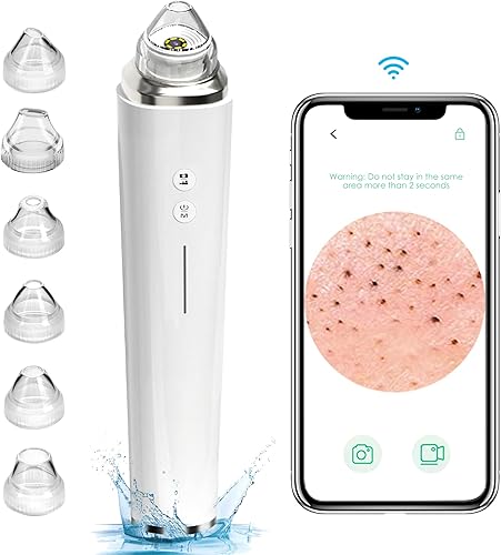 Aspirador de poros para eliminar puntos negros limpiador facial visible de poros con cámara HD kit extractor de acné con 6 cabezales de succión