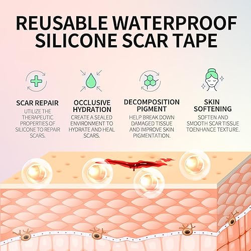 Miniatura 3 de Hojas de silicona médica para cicatrices, cinta de cicatriz de silicona, cinta de cicatriz reutilizable para cirugía de cesárea, queloides y