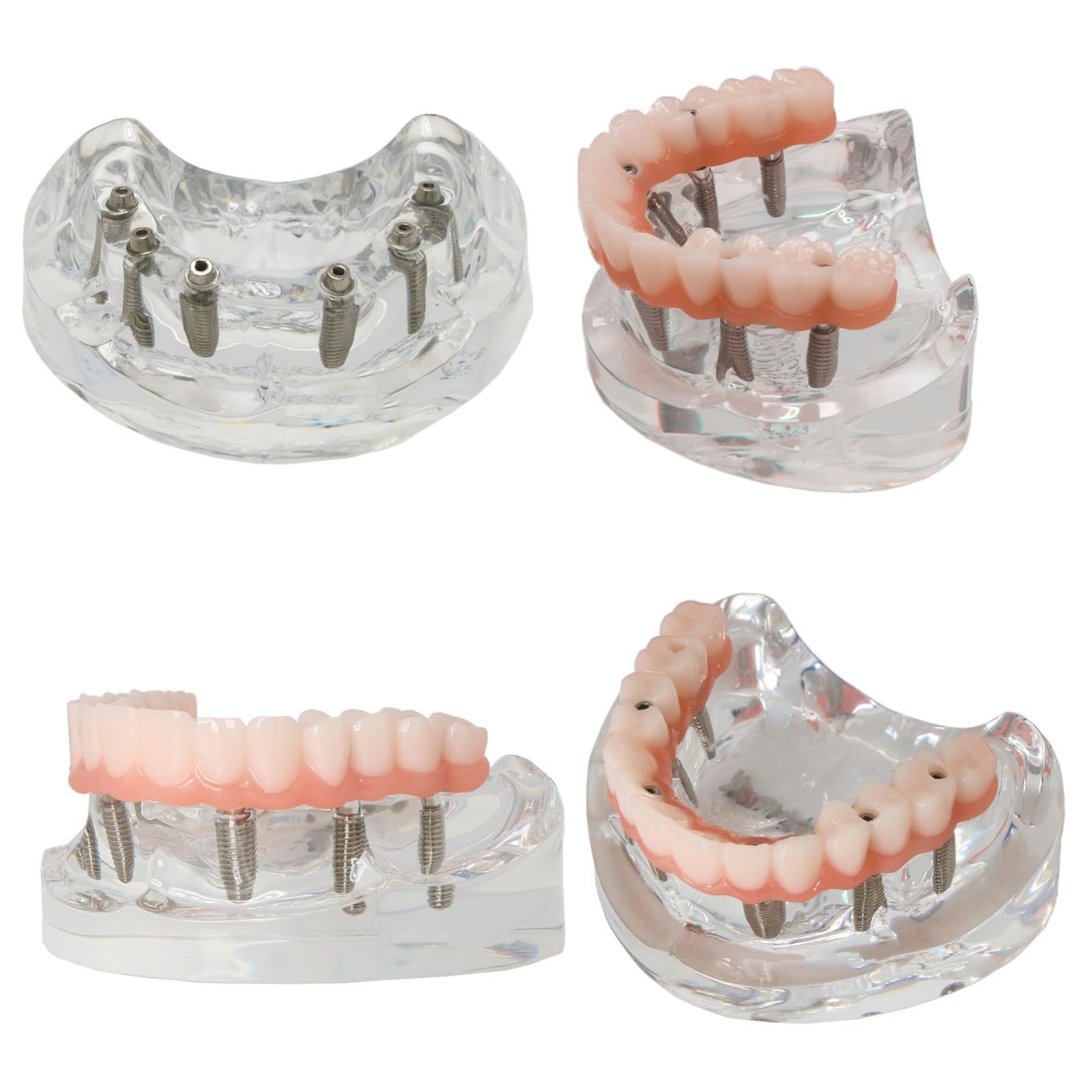 Modelo de implante dental de doble arco. Sistema de entrenamiento de sobredentadura All-On-6 y All-On-4. Bases transparentes para maxilar y mandíbula