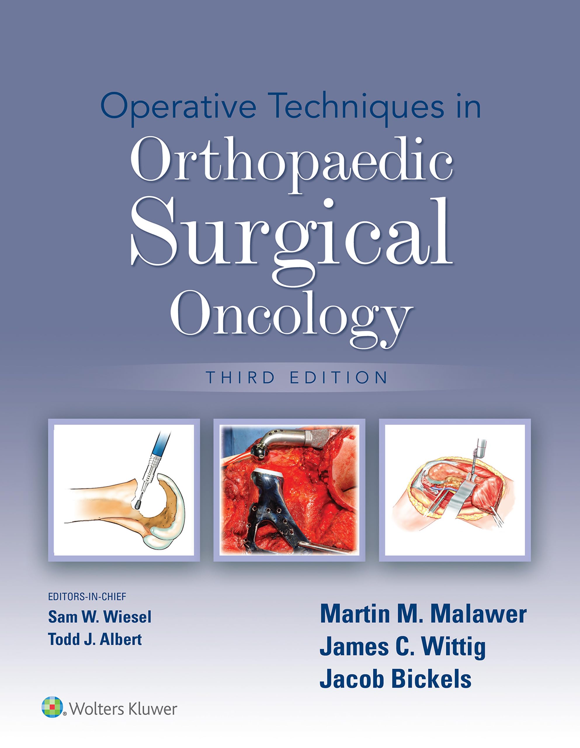 Operative Techniques in Orthopaedic Surgical Oncology (English Edition)