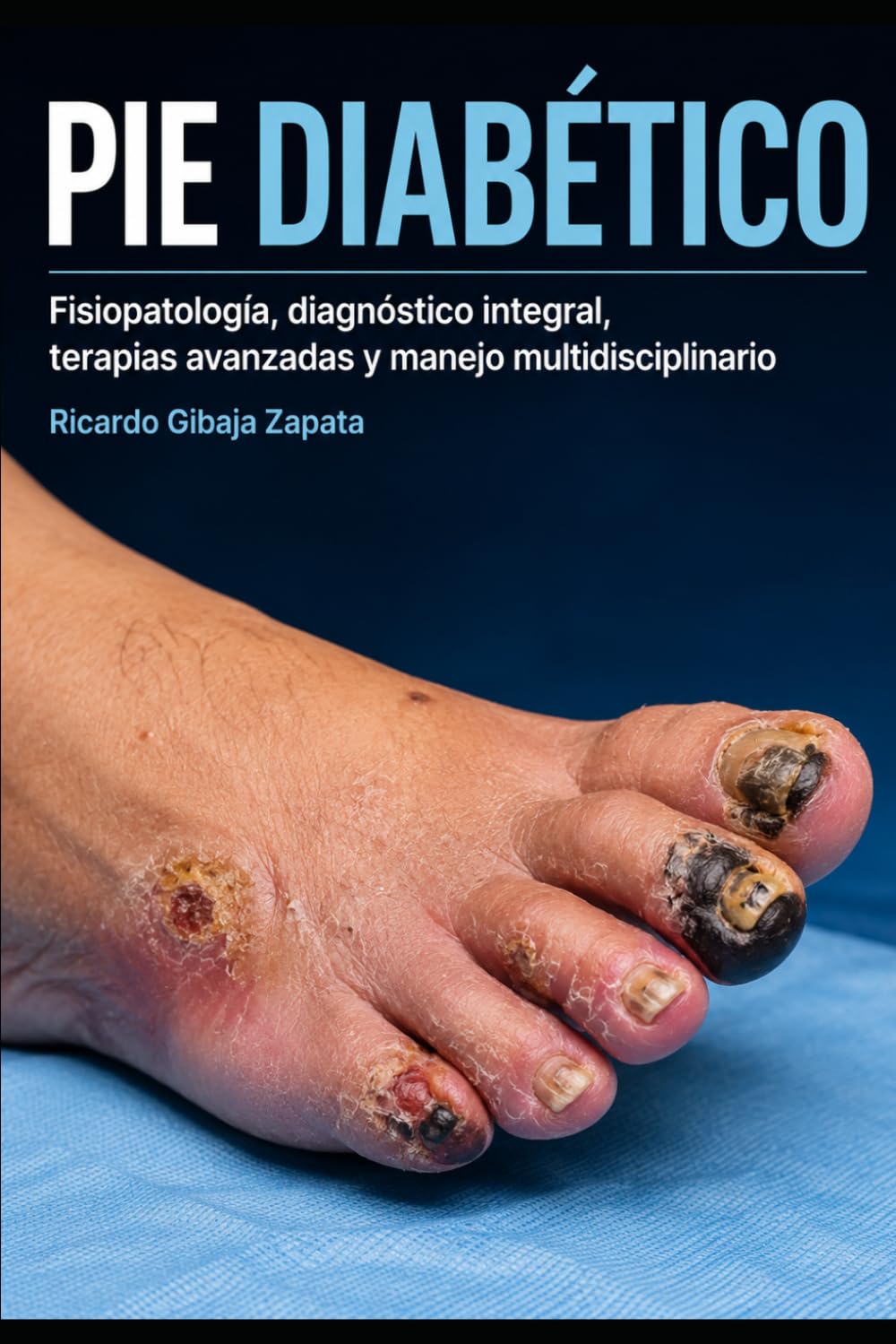PIE DIABÉTICO Fisiopatología, diagnóstico integral, terapias avanzadas y manejo multidisciplinario