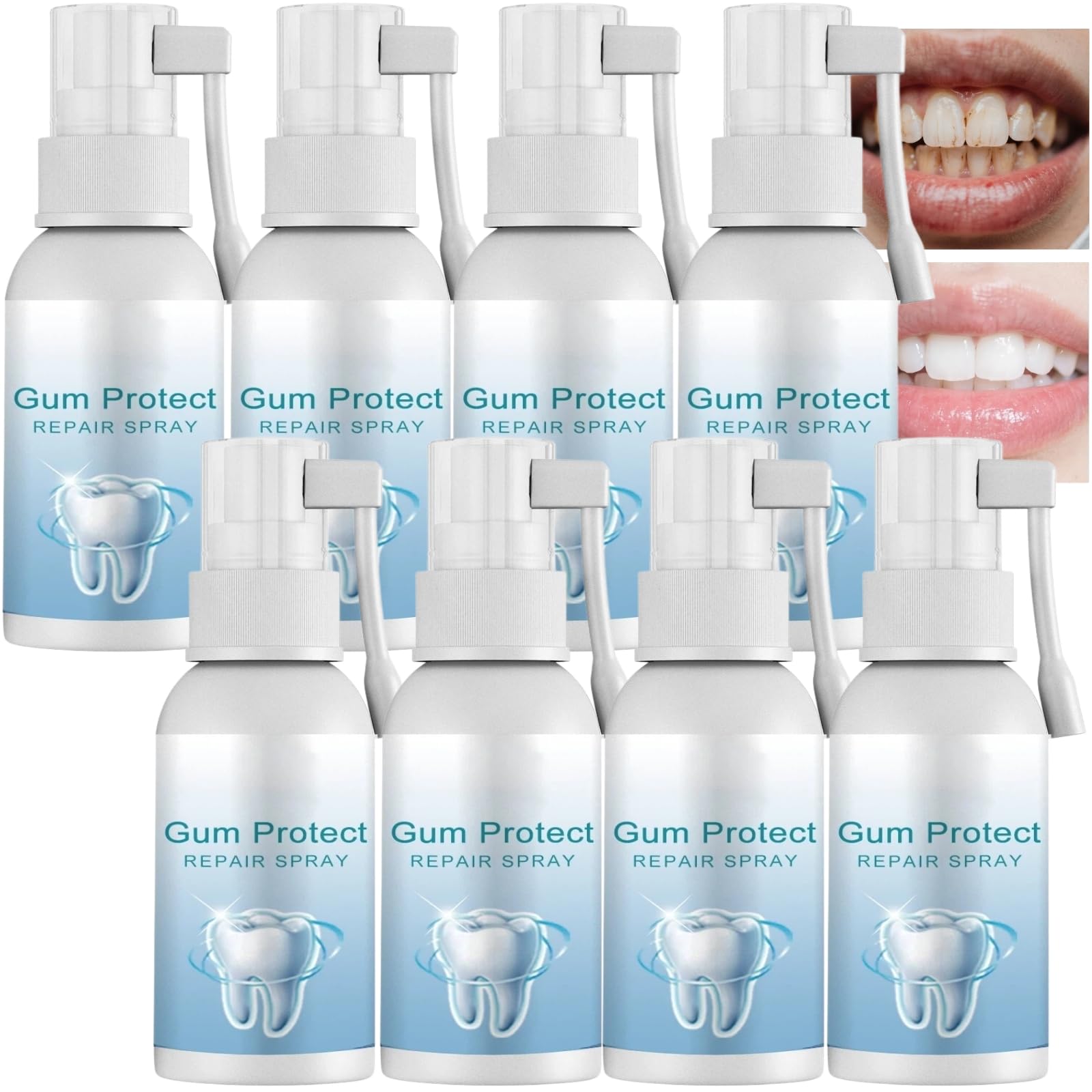 Trattamento riparatore per gengive retratte, spray antidolorifico dentale, spray orale alla propoli, sollievo dal mal di denti, lenimento rapido delle gengive, attenuazione (8 pezzi)