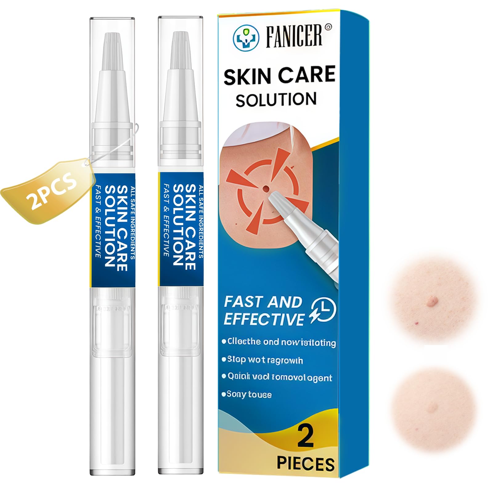 2 Pièces 5ml Stylo Anti Verrue, Liquide de soin verrues, Fluides pour éliminer les cuticules, Soin de la peau lisse, applicateur précis, Liquide Anti Verrues Pour plupart des types de peau