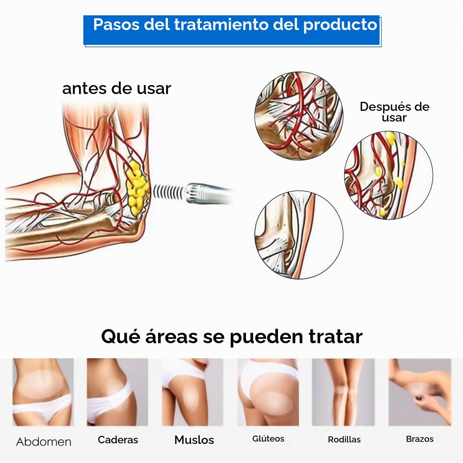 TELAM Máquina de terapia de ondas de choque Máquina de terapia de ondas de choque extracorpóreas electromagnéticas Mejora de la elasticidad de la piel Masajeador corporal