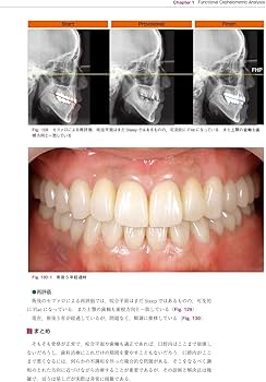 包括的治療戦略 Vol.2 for Functional Management | 土屋 賢司 |本