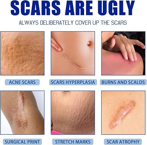 Miniatura 7 de Crema para cicatrices, crema para eliminar cicatrices, gel de silicona para cicatrices, gel de cicatrices, crema para cicatrices quirúrgicas,