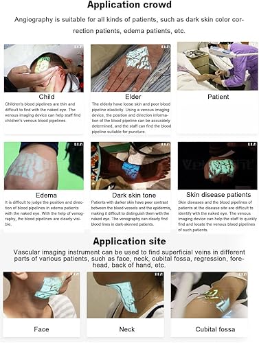 Miniatura 6 de Localizador de Venas Infrarrojo Buscador de Venas para Adultos y Bebés, Detector de Iluminación de Venas, Visualización de Proyección de Luz de