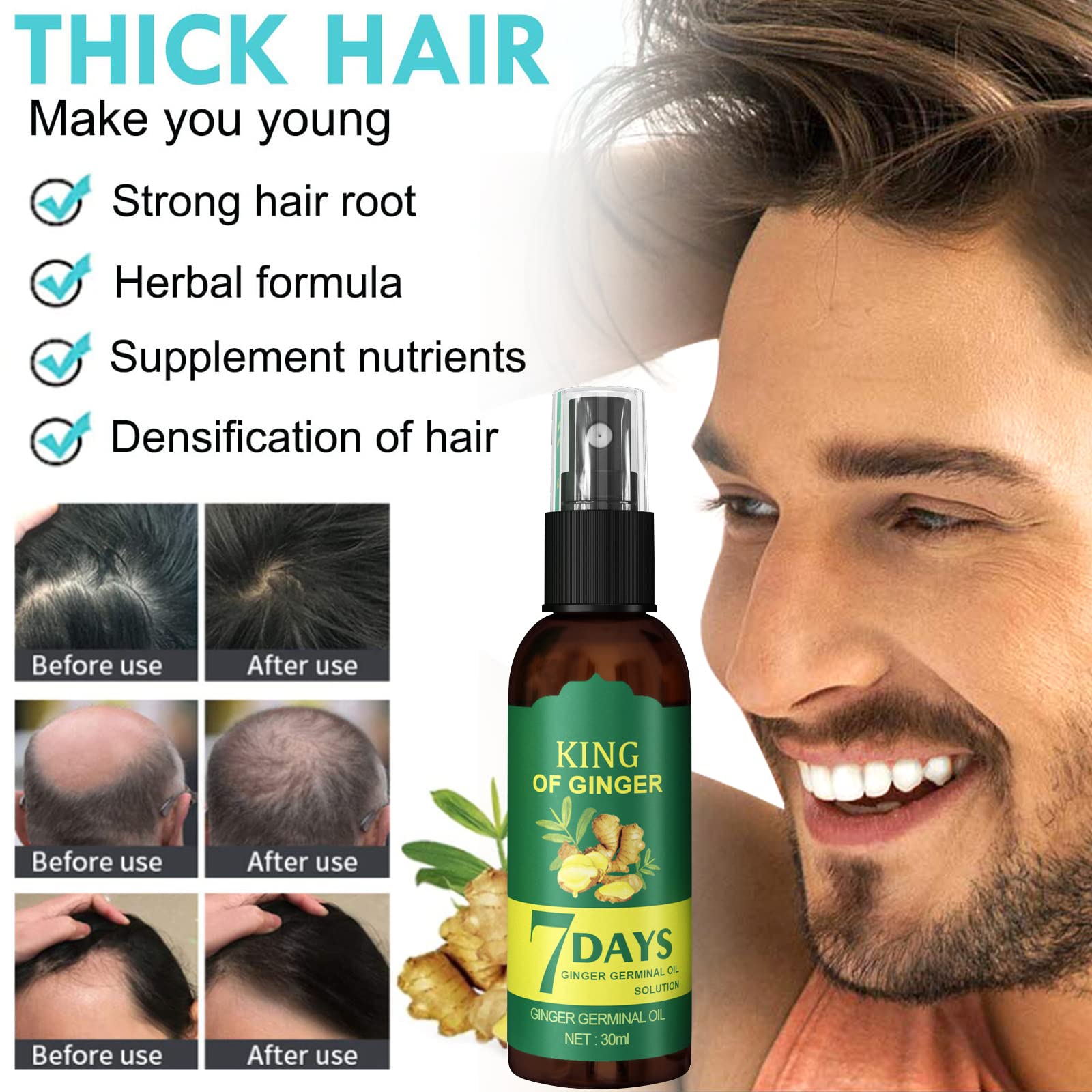 Amazon.com : Hair Growth Serum - Hair Regrowth Oil Prevent Hair