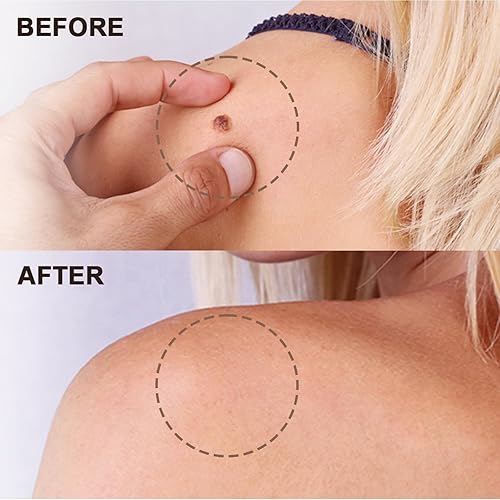 Miniatura 6 de Tratamiento integral profesional de restauración de la piel de veneno de abeja de acción rápida, crema que reduce eficazmente las imperfecciones,