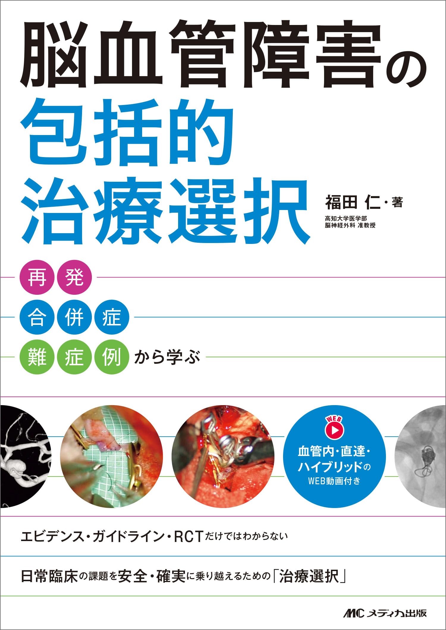 脳血管障害の包括的治療選択 再発・合併症・難症例から学ぶ