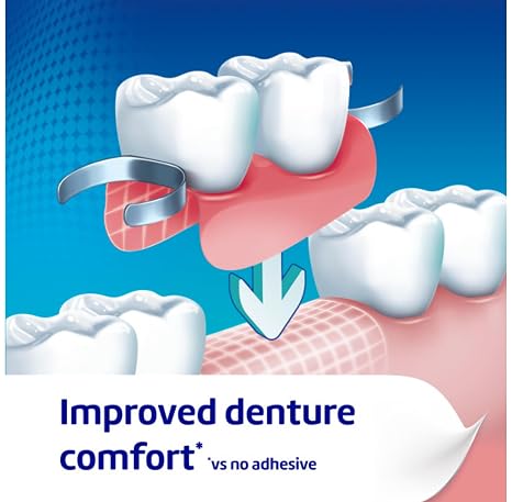 Poligrip Denture Adhesives Cream Ultra, Provides Strong all-day Hold for Dentures, 40g