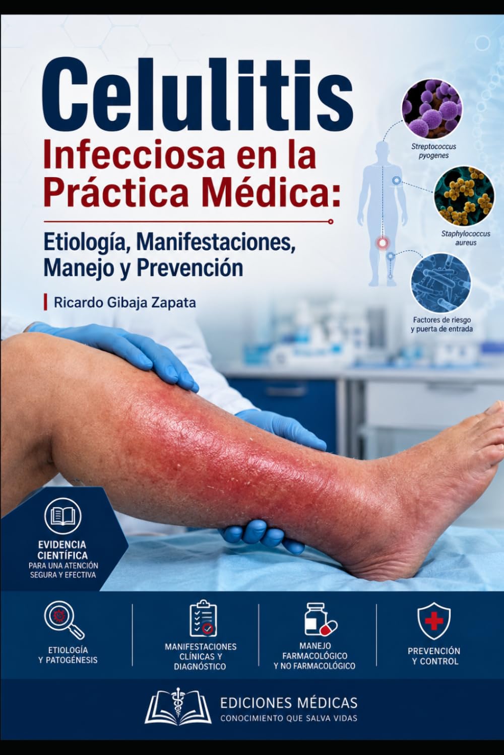 Celulitis Infecciosa en la Práctica Médica: Etiología, Manifestaciones, Manejo y Prevención