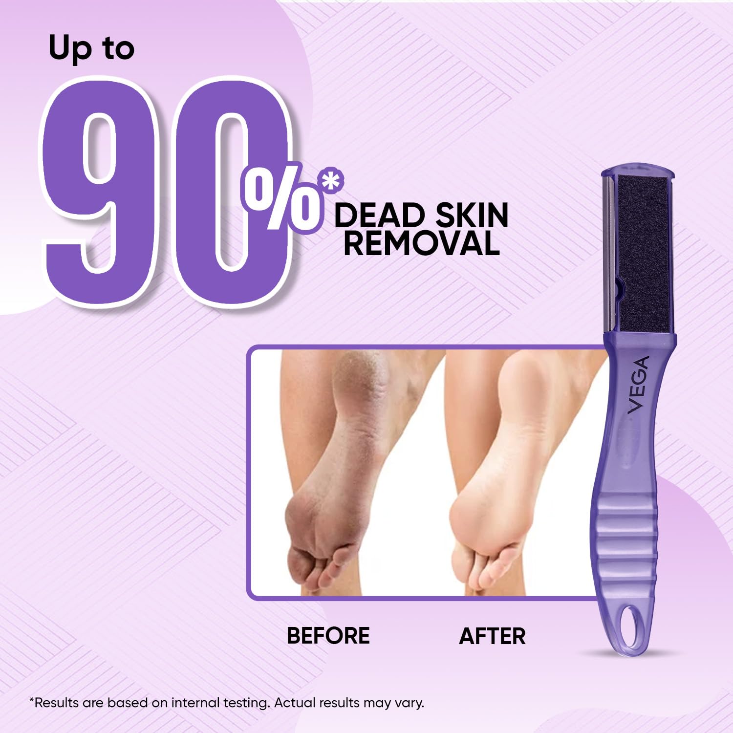 VEGA Portable Pedicure Foot File for Dead Skin, Hard Skin & Callus Removal | Dual-Sided Foot Scrubber for Cracked Heels | Smooth & Soft Feet | Pedicure Tool for Men & Women | Home & Salon Use (PD-03N) 1