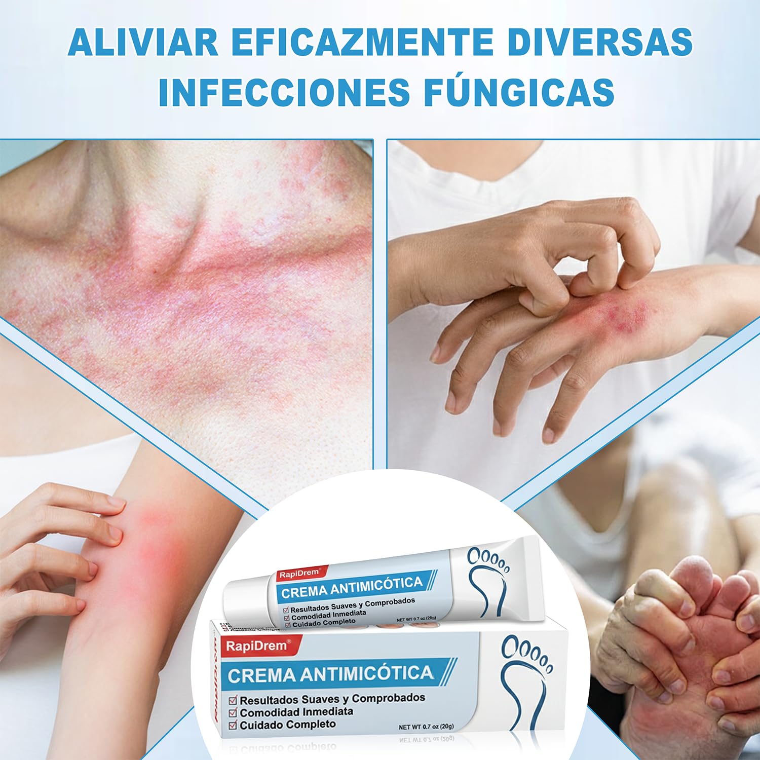 Crema Antifúngica - Crema Antifúngica para la Piel, Crema antimicótica para hongos pies y pie de atleta Calma los picazones y el malestar cutáneo, fórmula natural (1) - 5