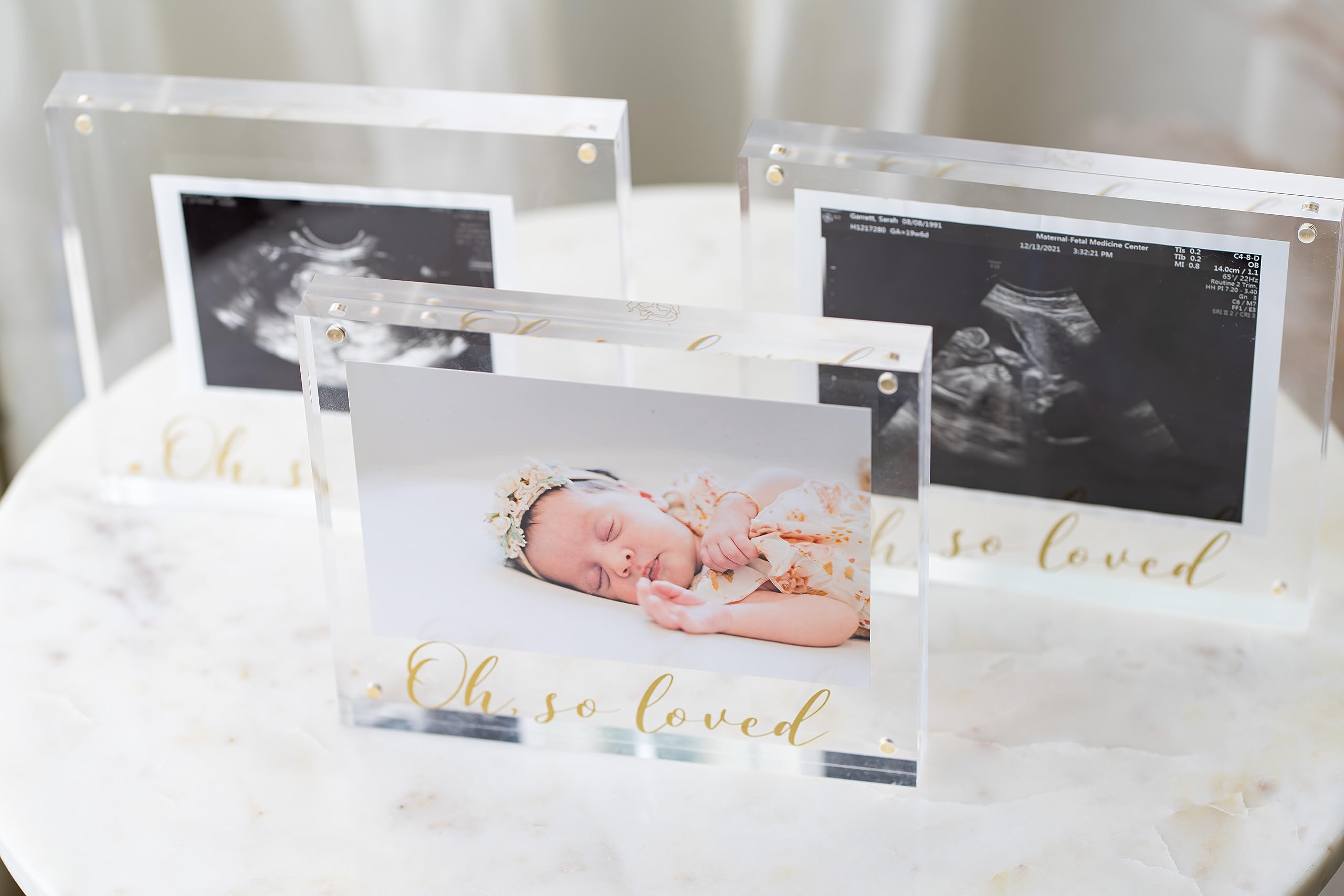 Ultrasound Picture Frame