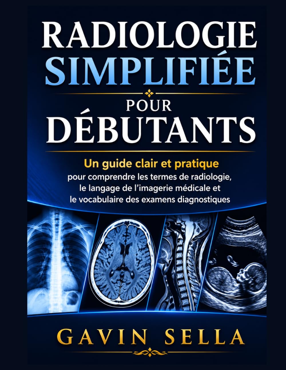 Radiologie Simplifiée pour Débutants: Un guide clair et pratique pour comprendre les termes de radiologie, le langage de l’imagerie médicale et le vocabulaire des examens diagnostiques