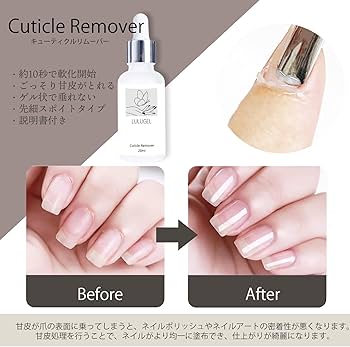 Amazon.co.jp: LULUGEL 甘皮処理 セット キューティクルリムーバー
