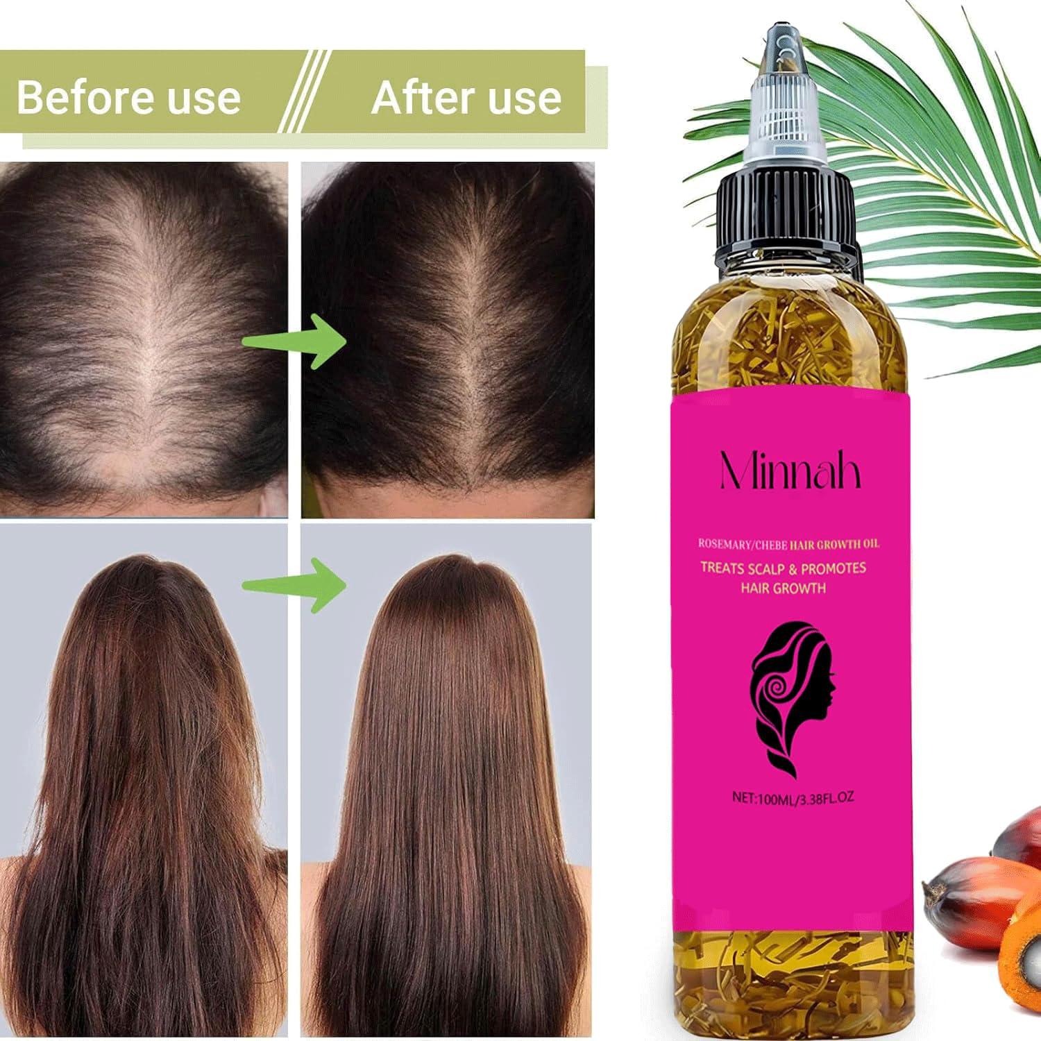 Minnah Batana Oil for Hair Growth 4-in-1 Liquid, 1pcs | Crack Hair Growth Oil, With Rosemary, Pumpkin Seed, Castor