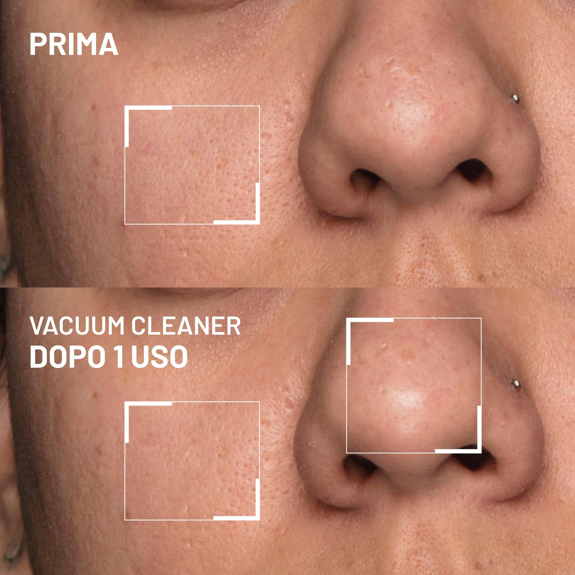 Dr. Brandt Pores No More Vacuum Cleaner - Maschera purificante pori per liberare e restringere i pori - 30 g