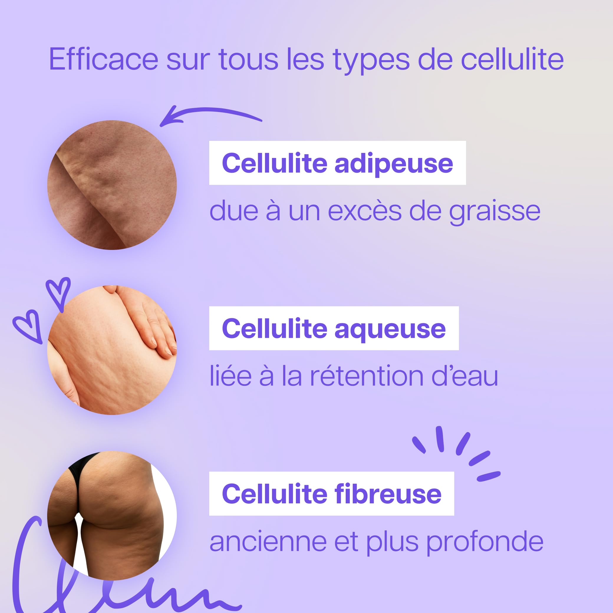 Ventouse Anti-Cellulite Électrique - Palper-rouler Automatique & Aspiration Puissante - Réduit la Peau d’Orange Rapidement - Cible Tous Types de Cellulite - Ventre, Cuisses, Bras, Jambes