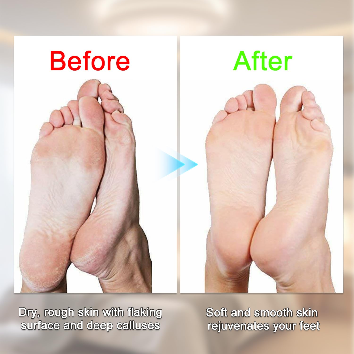 2024 New USB Rechargeable Foot Repair and Grinding Device, Electric Foot Grinder for Callus Remover, Electric Foot File Polisher, Feet Callus Remover Machine (Blue)