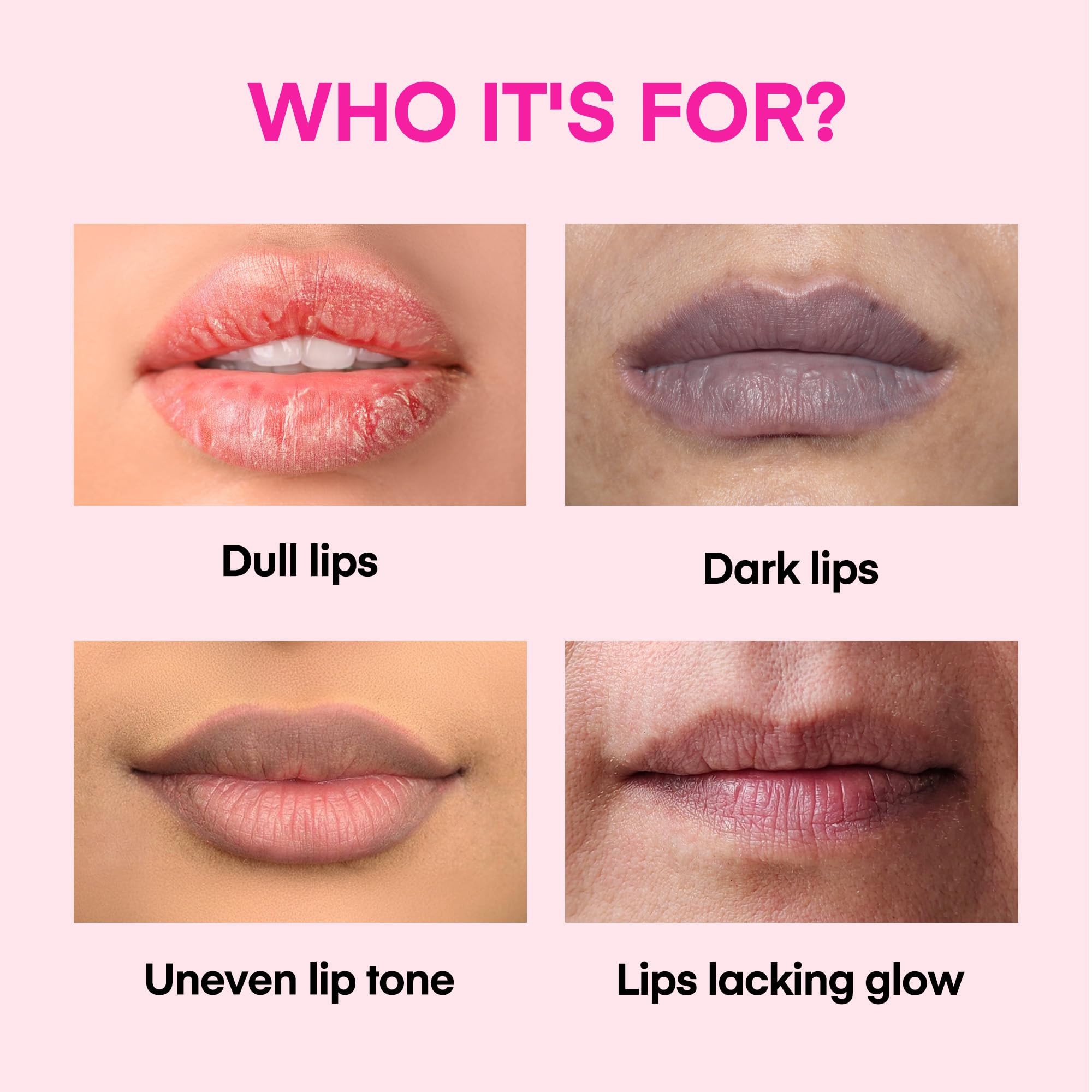 can glutathione lighten dark lips Amazon.com : KissBea Lip Lightening for Dark Lips: for Smokers, Dry or  Uneven-Toned Lips – Restores Natural Look & Moisture with VC, Lemon Peel &  Licorice – Refreshing Mint Scent – 15
