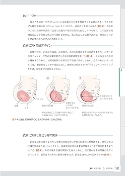 脳神経外科レジデントのためのベーシック手術 | 齋藤竜太 |本