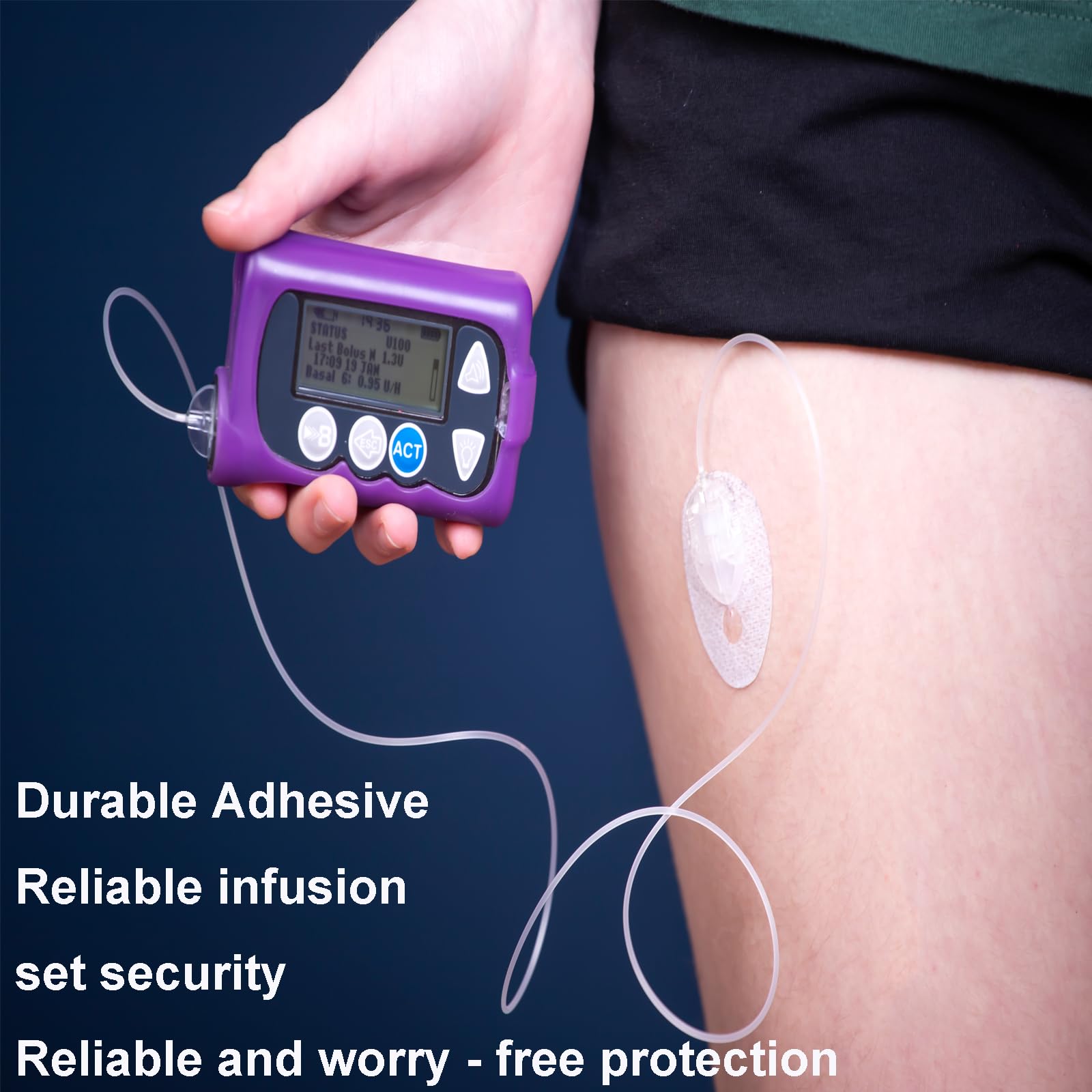 Universal-Klebepflaster für CGM- und Insulinpumpen, 2,3 cm großes Loch, atmungsaktive, transparente Flicken und wasserdichte CGM-Sensor-Pflaster, 10–14 Tage, CGM-Schutz, vorgeschnittenes Klebeband,