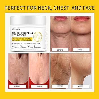 Amazon.com: Irismistx neck cream, neck tightening cream