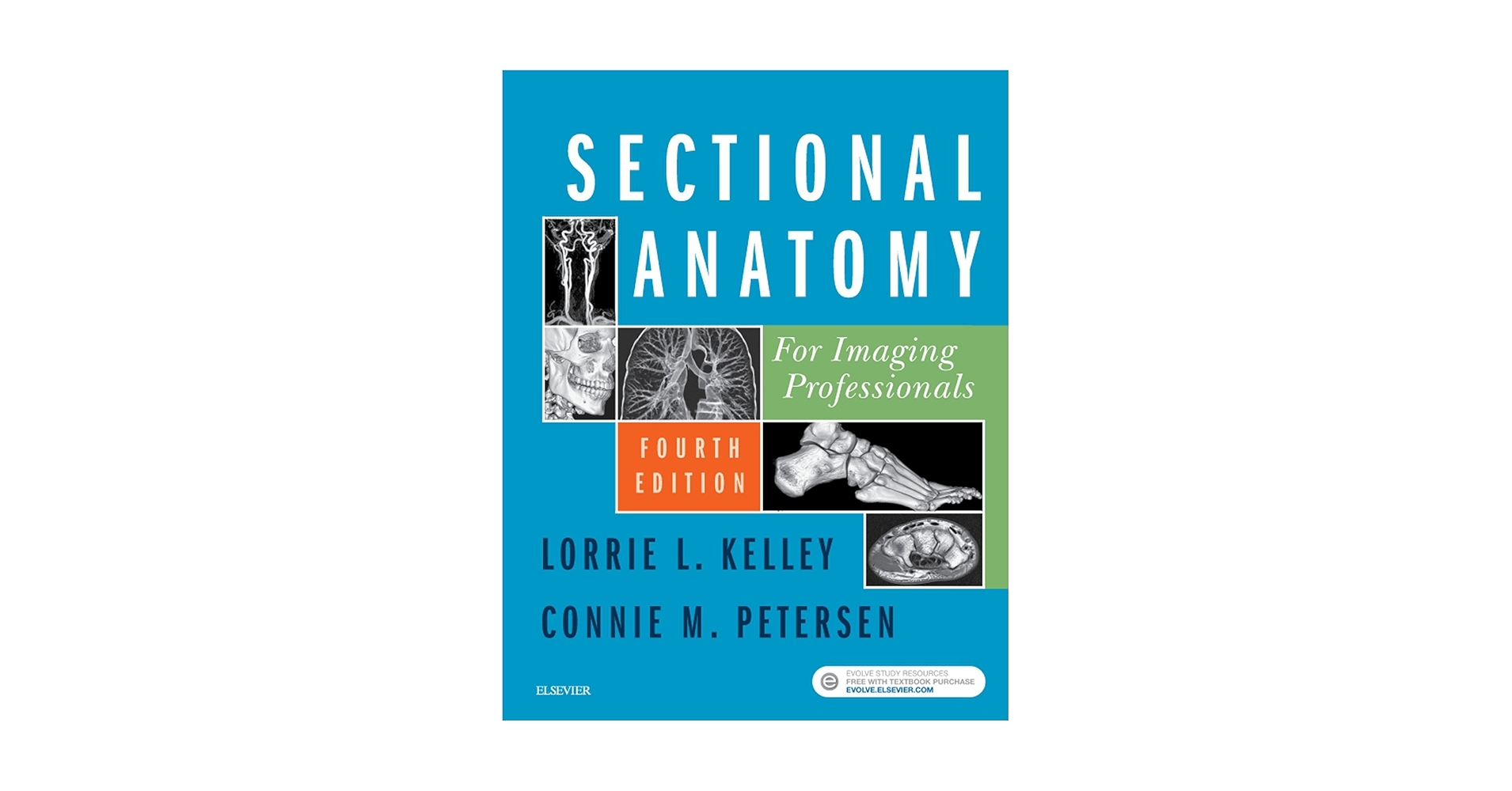 Amazon.com: Sectional Anatomy for Imaging Professionals - E-Book