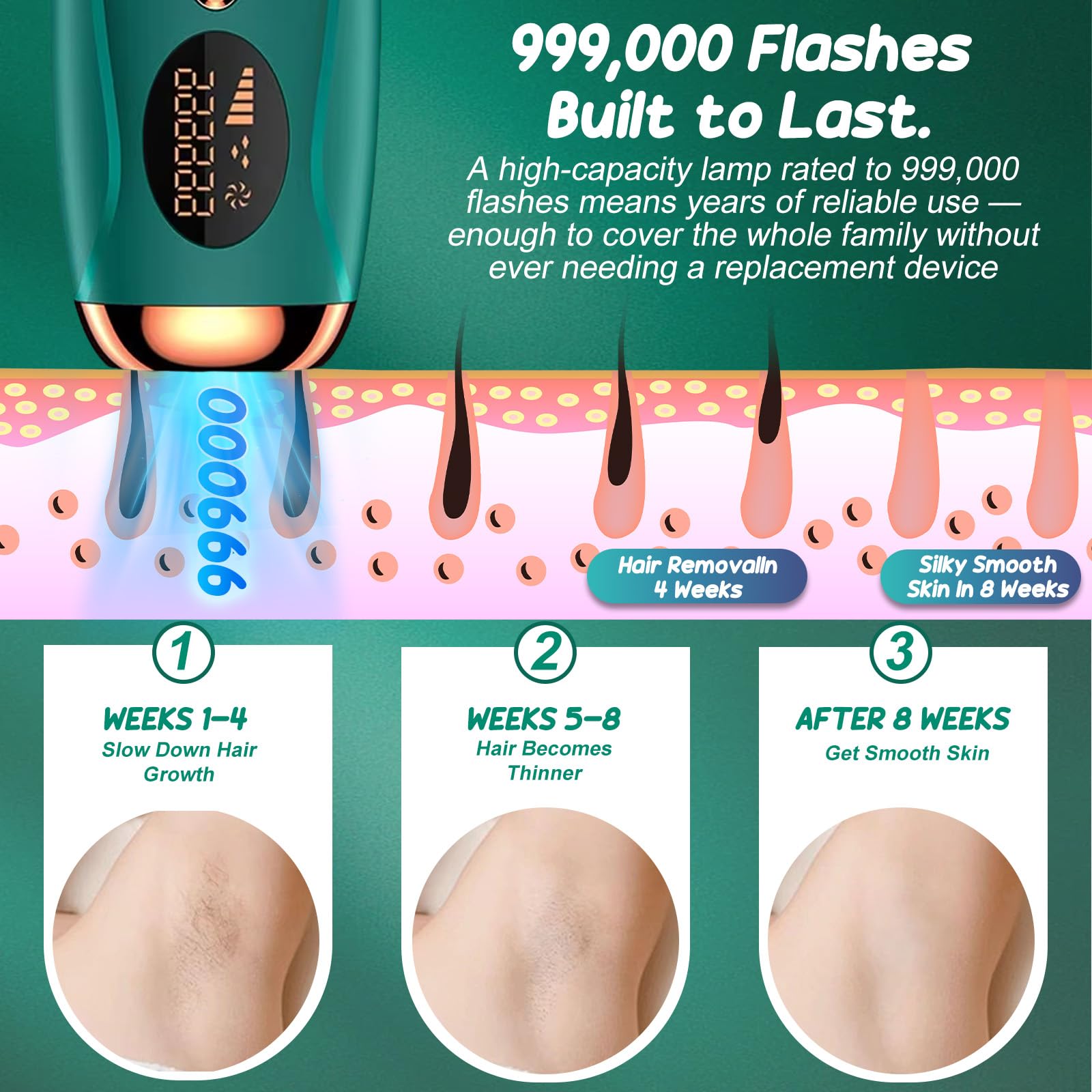 Dispositivo de depilación IPL para mujeres, 999,000 flashes, 5 niveles de potencia, removedor de vello facial para cara, bikini, cuerpo, piernas, axilas, dispositivo de depilación en casa para