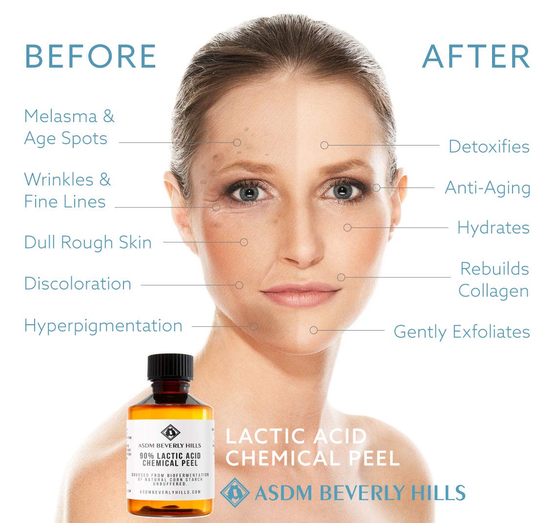 Buy ASDM Beverly Hills Lactic Acid Peel 90 2oz 60ml Medical Strength