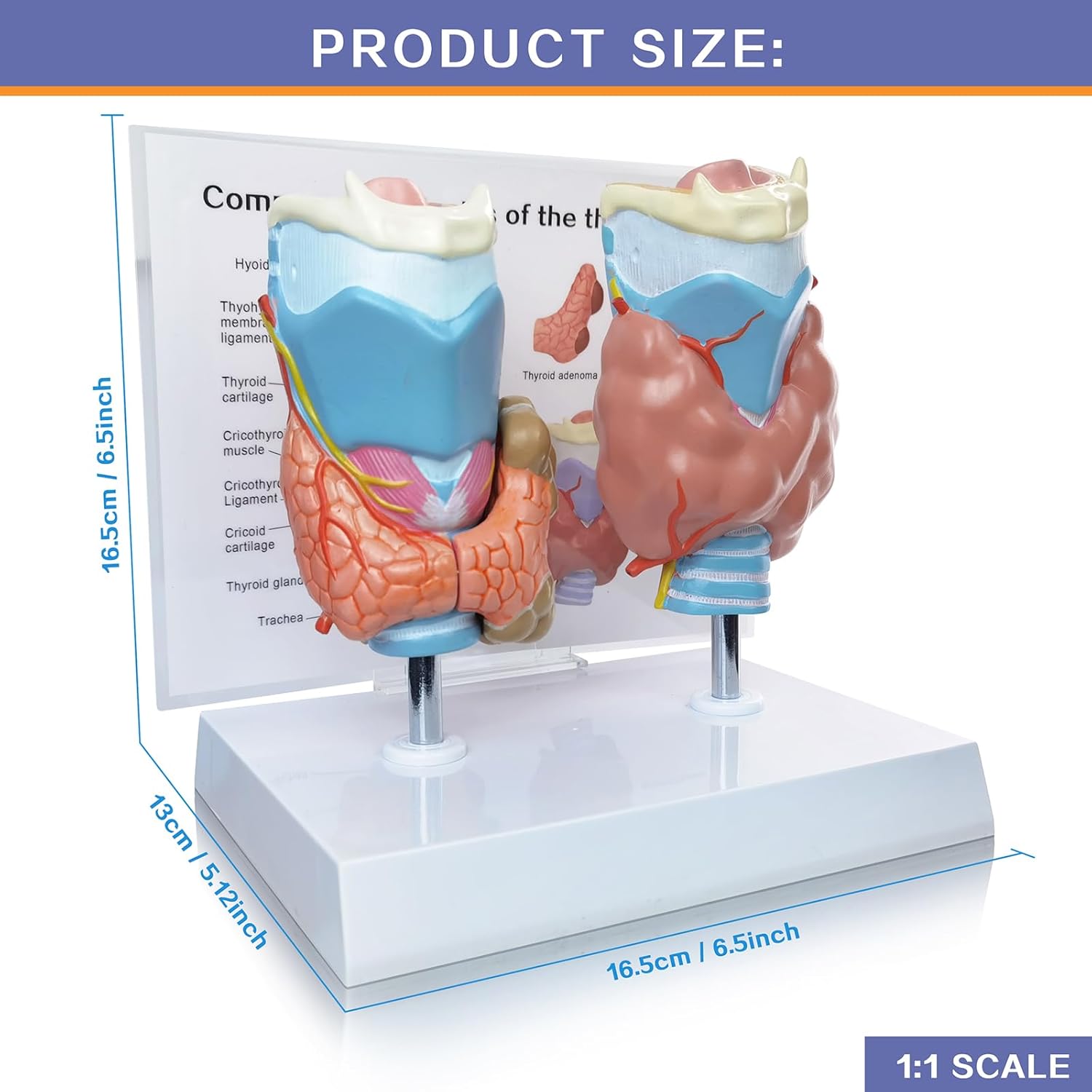 EVOTECH SCIENTIFIC Human Thyroid Pathology Anatomical Model - 4 Parts Life Size Medical Study Education Tool W/Stand and Manual for Demonstrating Goiter, Thyroid Cancer, and Graves’ Disease