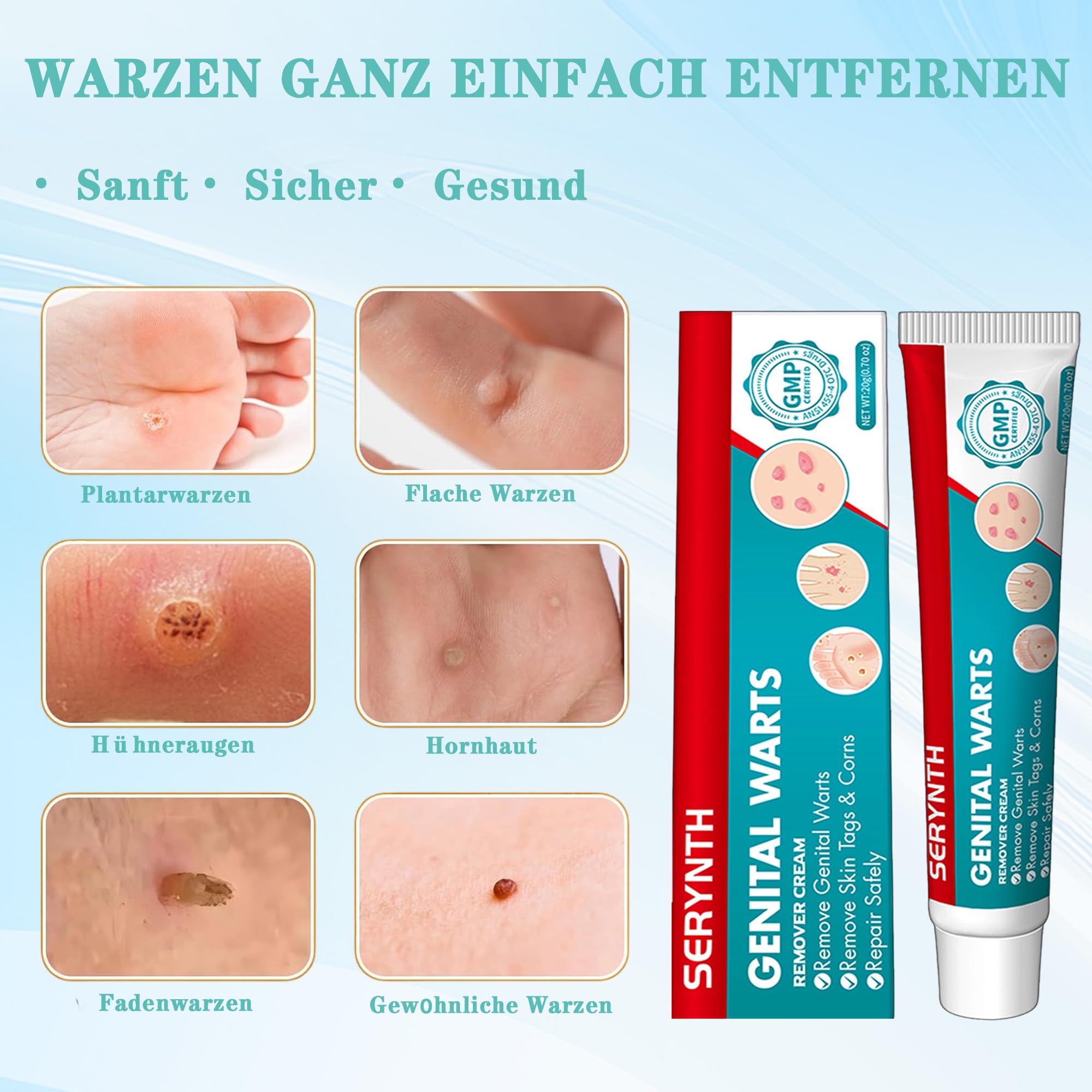 Warzenentfernercreme – geeignet für alle Hauttypen (20G)