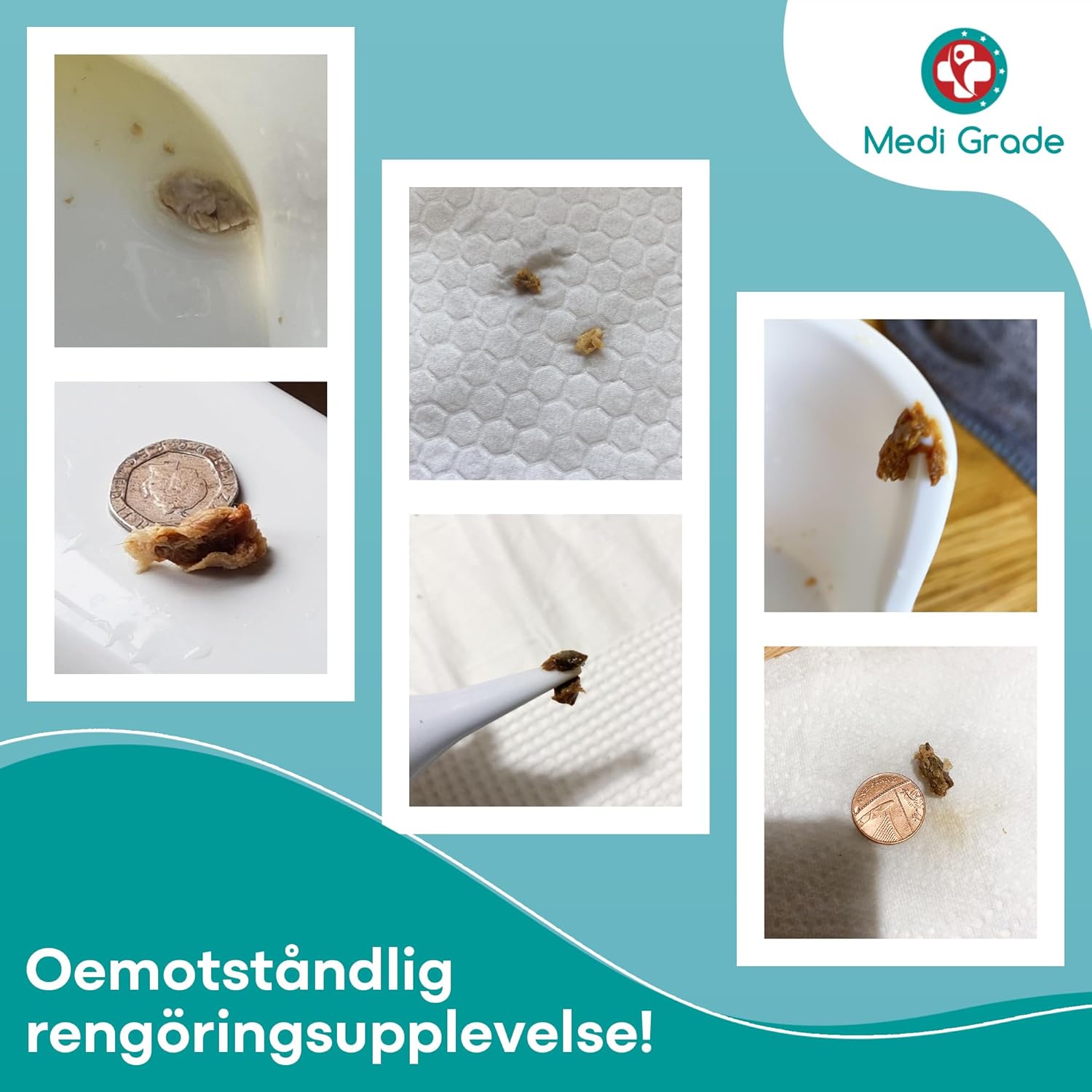 Examples of earwax removed using the kit