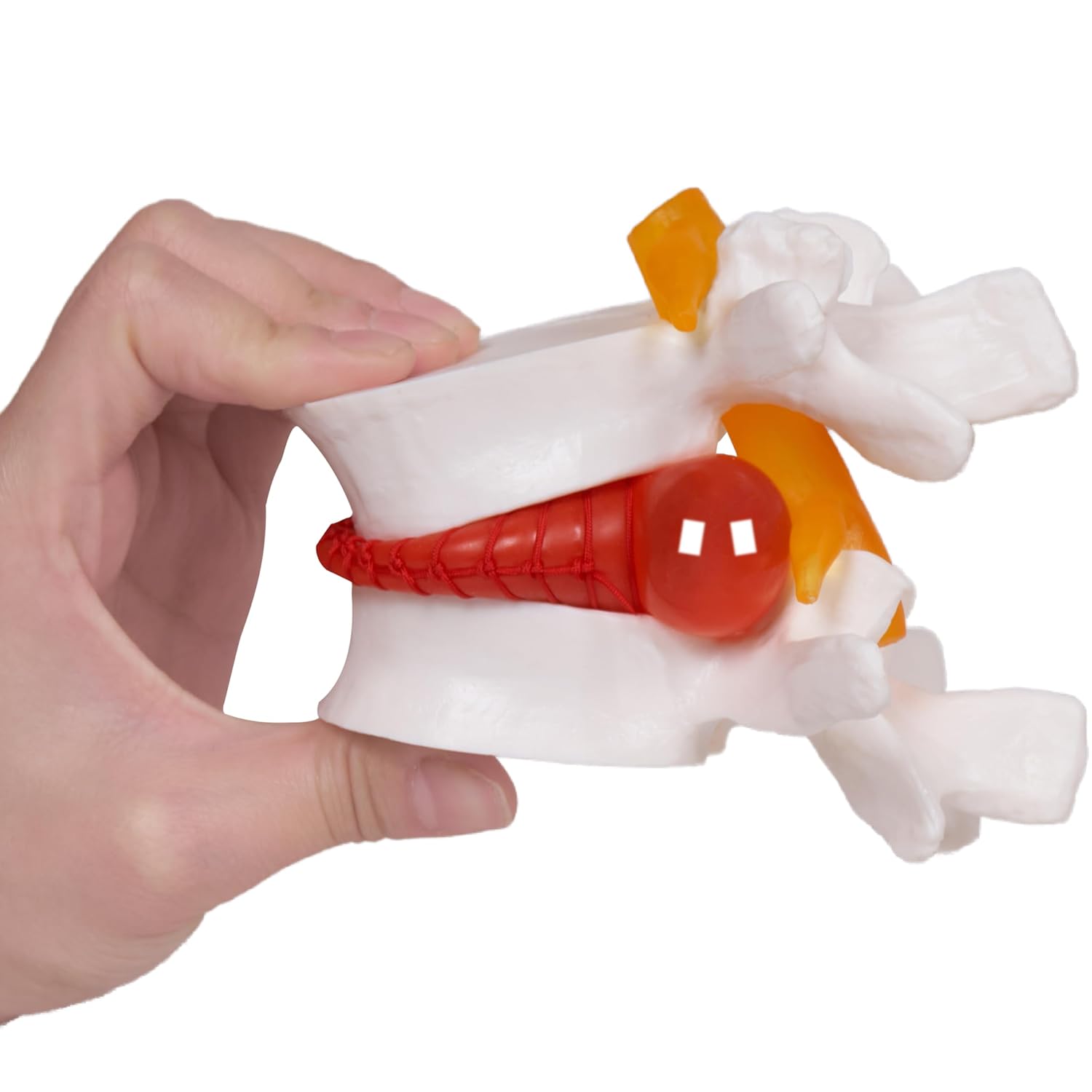 breesky Human Anatomical Lumbar Disc Herniation Model:1.5 Times Life Size Lumbar Disc Teaching Model Tool-for Medical & Learning & Teaching and Scientific Presentations