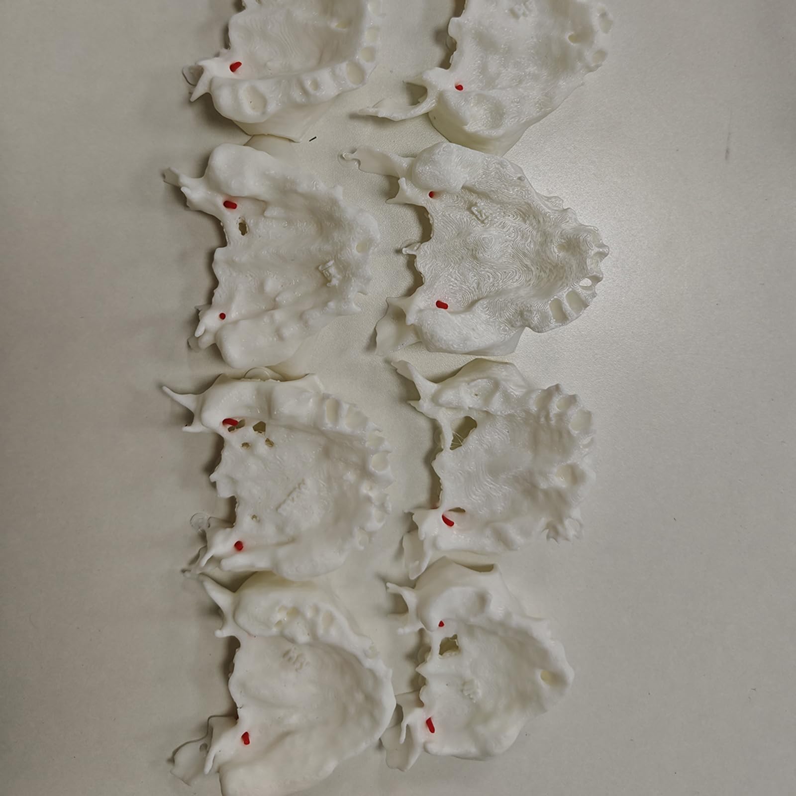 10 Pezzi Modello Dentale dei Denti Include Esercizi di Impianto dell'Arteria Palatina Basati su CT Modello Dimostrativo per Impianto Denti Trasparenti per Studio e Insegnamento