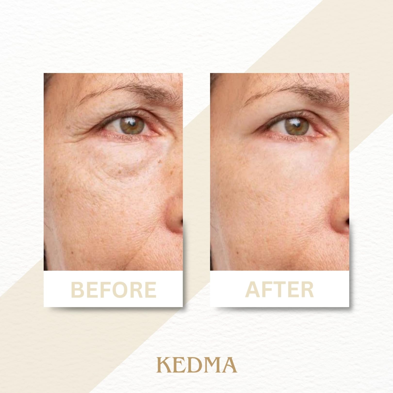 KEDMA - Sérum Minéral Anti-Âge - Hydratant & Revitalisant pour Peau - 30ml | Le sérum minéral hydrate, revitalise et aide à lisser l’apparence des signes de l’âge pour un teint éclatant.