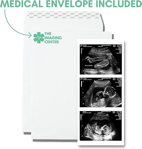 Miniatura 3 de Pranknant Imágenes de broma de ultrasonido falso  Tira 2D de 3 fotos  Sonograma de embarazo  Ultrasonido de embarazo de broma (gemelos)