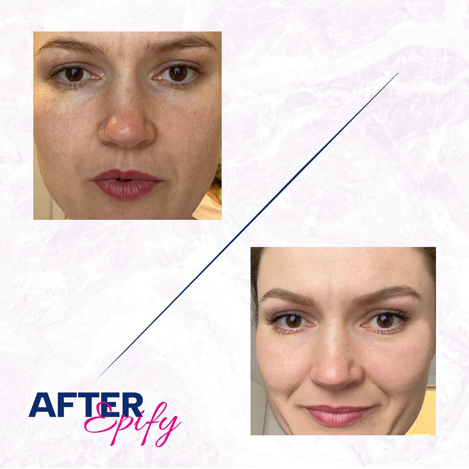 Epify Ultra Personal Care Set, Hair Removal Cream, Superfruit Post Epilation Papaya Gel, Glutathione Shot, Smooth & Fresh Roll-On