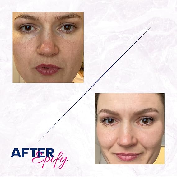 Epify Radiant Glow Face Care Set, Superfruit Post Epilation Papaya Gel, Glutathione Shot with Glutathione & Arbutin, Hair Inhibitor for Face and Body, Gentle Peeling and Hydration